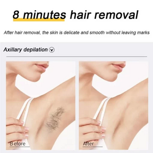 Ecrin Hair Removal Spray - Eluna